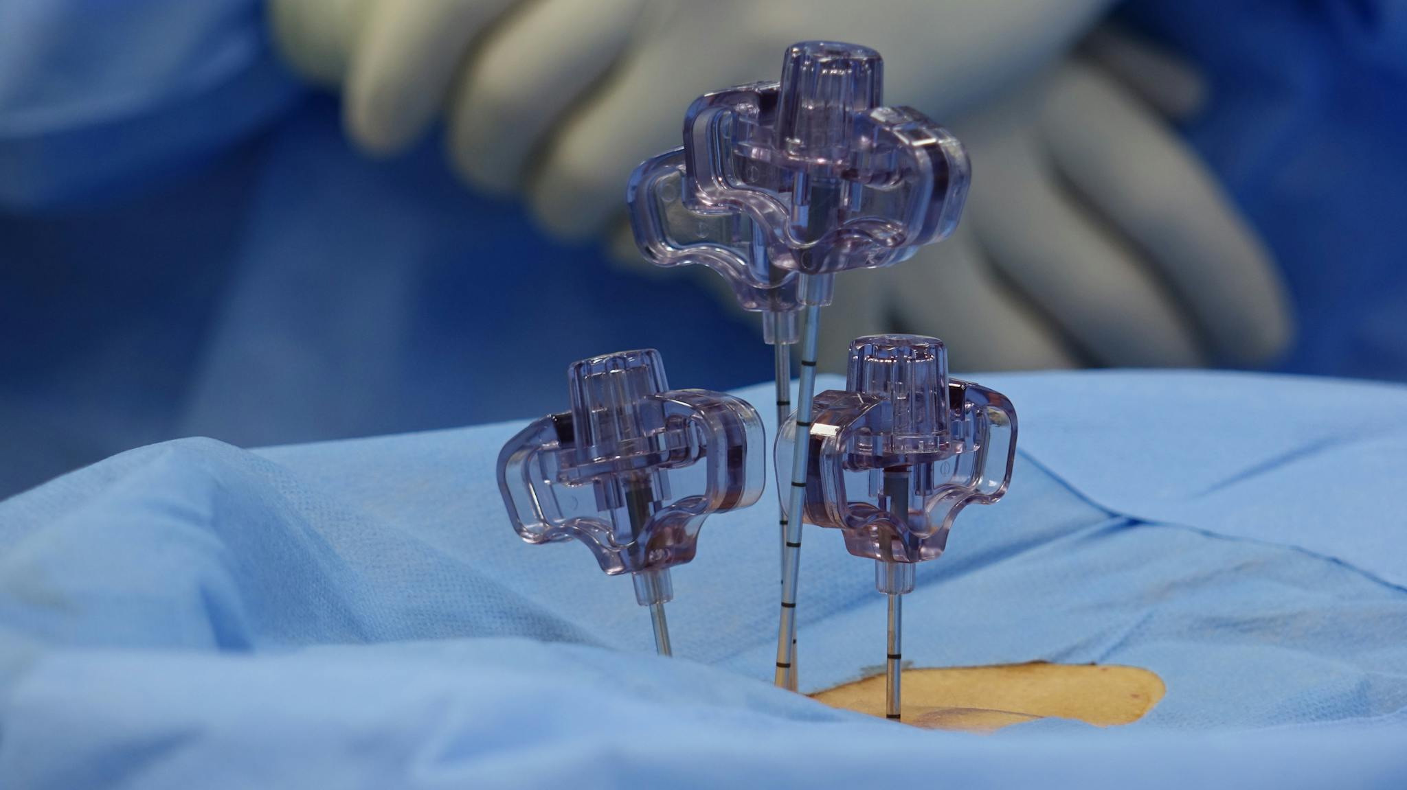Close view of surgical tools during a spinal procedure in an OR.