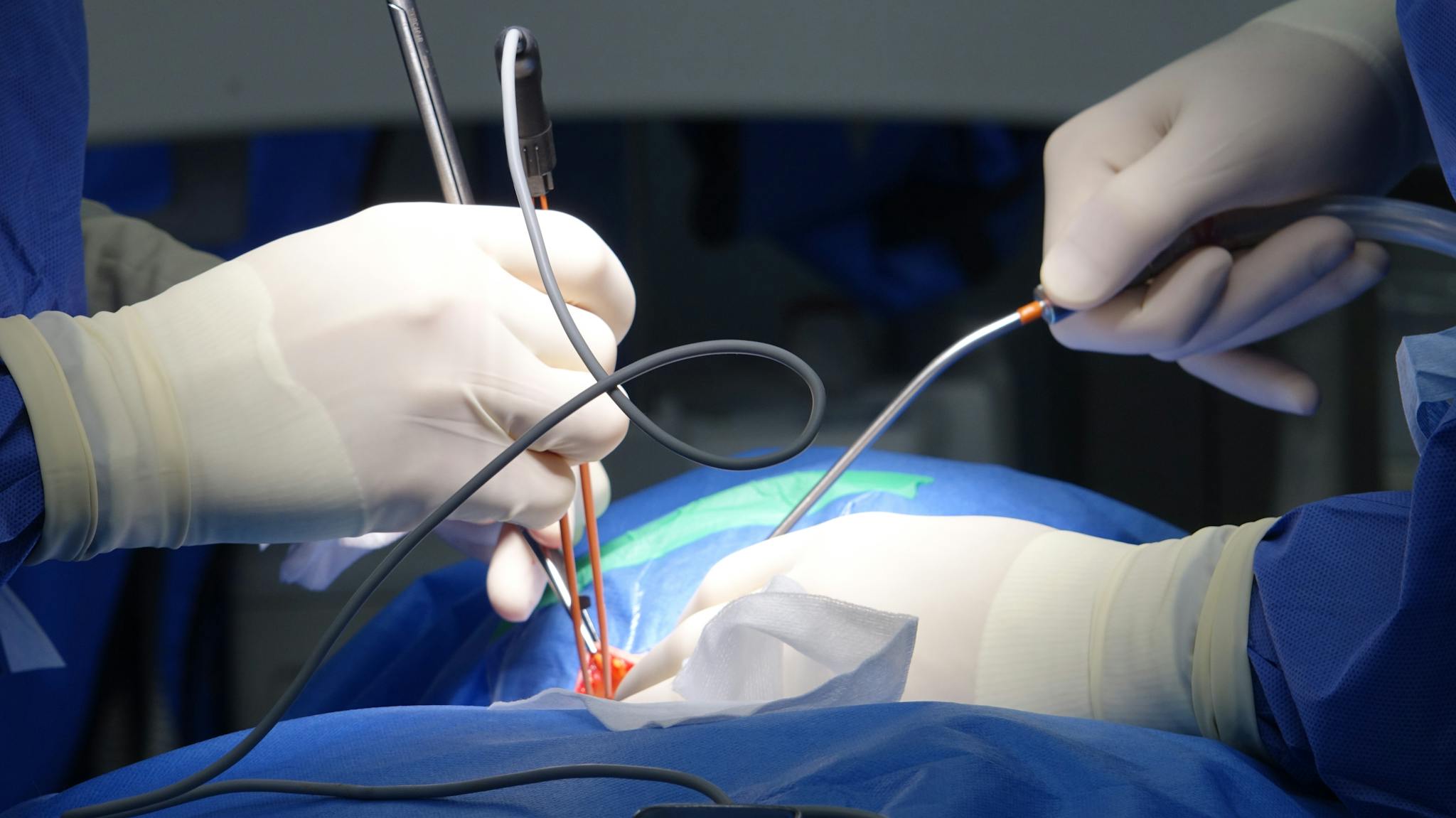 Surgeons performing a delicate medical operation with precision tools and gloves.